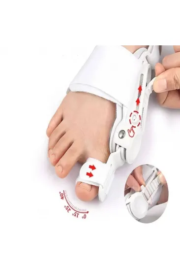 Ayarlanabilir Ayak Baş Parmak Kemik Düzeltici – Halluks Valgus (Bunyon) Aparatı, Gece Gündüz Kullanıma Uygun Ayak Düzeltme Ateli (5637) Ayarlanabilir Ayak Baş Parmak Kemik Düzeltici – Halluks Valgus (Bunyon) Aparatı, Gece Gündüz Kullanıma Uygun Ayak Düzeltme Ateli (5637)